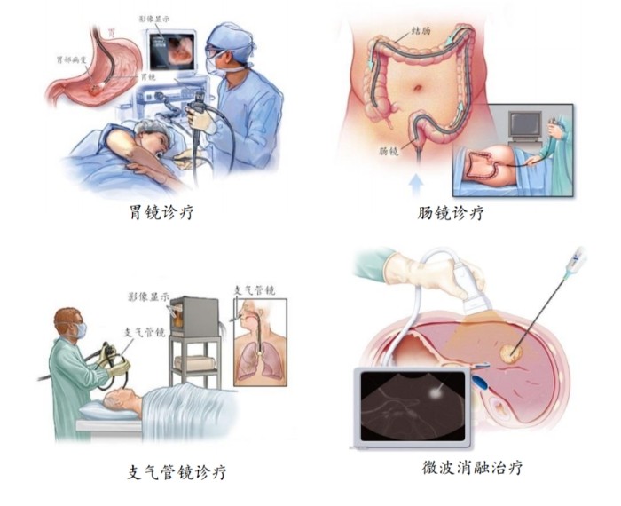 醫用內窺鏡介紹 醫用內窺鏡介紹